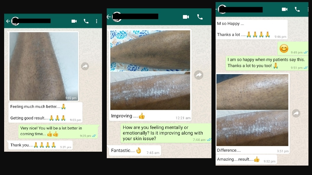 Tinea Pedis problem